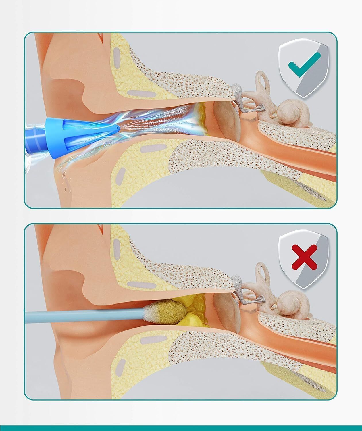 Ear Wax Removal Syringe - Natural Ear Cleaner for Safely Removing Ear Wax at Hom